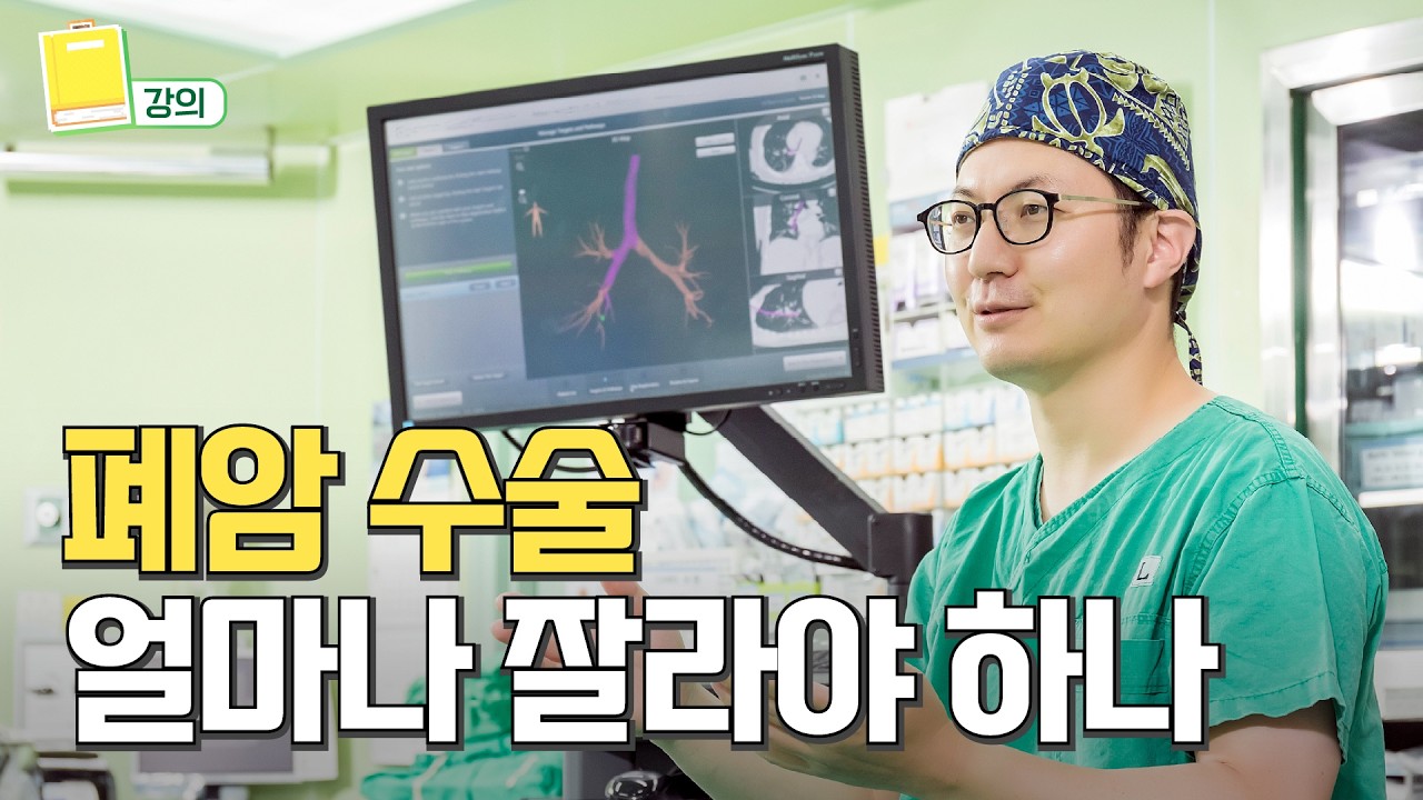 폐암 수술, 얼마나 잘라내야 할까요?