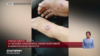 12 человек заразились сибирской язвой в Акмолинской области