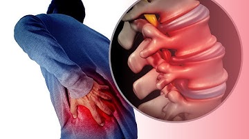 Sciatica SOS: Secrets to Conquer your pain and win your life back| Mr. Ahmed Sadek Neurosurgeon
