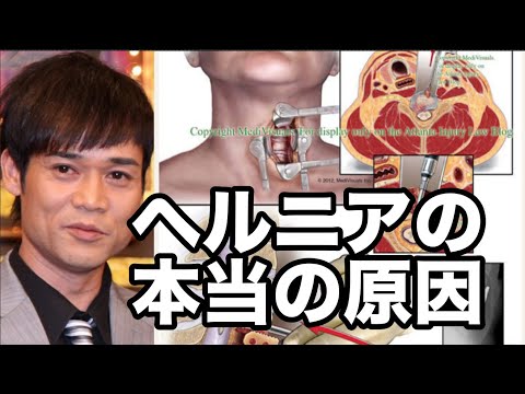 ネプチューン 名倉潤の悲劇【ヘルニア 手術 ストレッチ】The real cause of cervical hernia