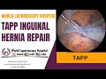 Transabdominal preperitoneal tapp inguinal hernia repair a entire procedure overview