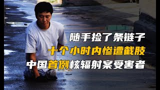 他只因隨手撿了壹串“鑰匙鏈”，就慘遭截肢七次，還差點丟了性命！中國首例核輻射案受害者的壹生！The son of China's first nuclear radiation victim!