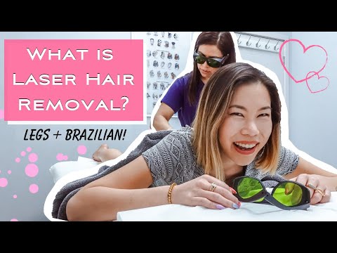 my-laser-hair-removal-experience-|-legs-&-brazilian