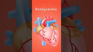 how bradycardia heart works😱?#heart  #animation #youtubeshorts #shorts