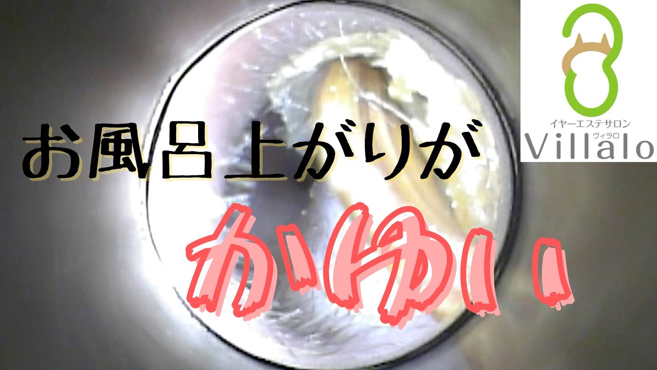 耳掃除動画vol.116「お風呂上りが痒い」