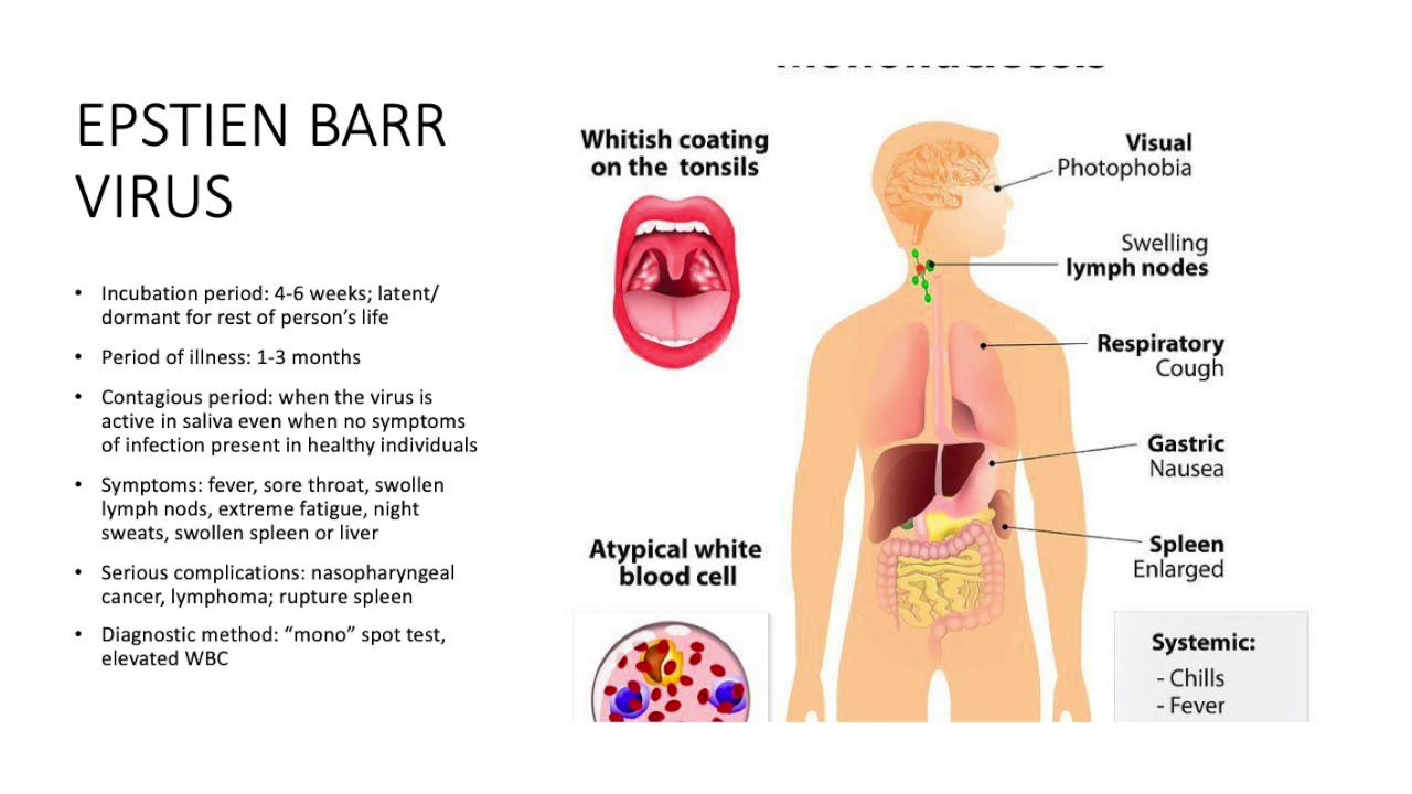 Infektivna mononukleoza | sarahbband.com