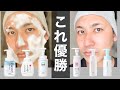 【本音レビュー】人気泡洗顔6選ガチ検証！洗顔極めて美肌を制す【2022年版】