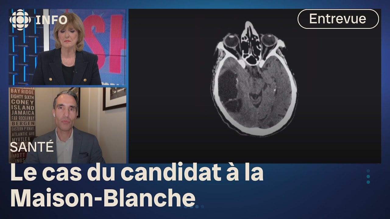 Robert Kennedy Jr a eu le cerveau  rong par un ver   2460