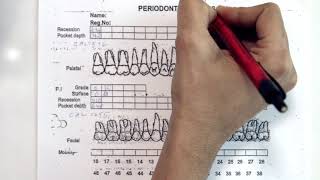 [Periodontal Examination Series] 13. Periodontal Charting Form