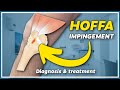 How to diagnose and treat hoffa impingement