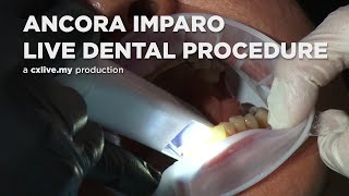Ancora Imparo - Live Medical Procedure On-Stage (Dental Conference/Convention)