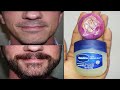 How to Grow Long Beard Naturally with Onion &amp; Vaseline | Get Full Beard On Face Home Remedies