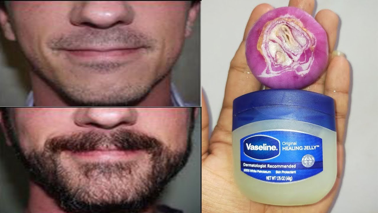 How to Grow Long Beard Naturally with Onion & Vaseline Get Full Beard On Face Home Remedies