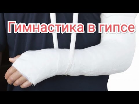 Упражнения после перелома локтевого сустава. Контрактура локтевого сустава: симптомы, лечение после перелома, упражнения Как разработать после перелома локтевой сустав – Как разработать руку. Упражнения для разработки локтевого сустава после перелома: разработка.