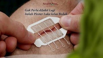 Inovasi Plester! Tak perlu Jahitan lagi untuk Luka Koyak