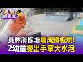 員林滑板場曬成鐵板燒！放肉片2分鐘全熟 4歲童小腿慘燙出「手掌大水泡」包紗布 父母怒控現場無警示【民怨調查局】