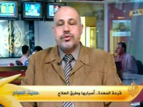 حديث الصباح : قرحة المعدة..أسبابها وطرق العلاج