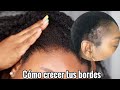 Cómo  hacer CRECER el CABELLO de las ENTRADAS | Cómo hacer crecer el cabello de los bordes | Rihanel