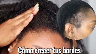 Cómo  hacer CRECER el CABELLO de las ENTRADAS | Cómo hacer crecer el cabello de los bordes | Rihanel