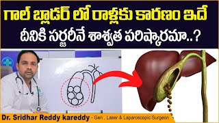 పిత్తాశయంలో రాళ్లకు చికిత్స | How to Remove Gallbladder Stones Naturally | Treatment Range Hospital