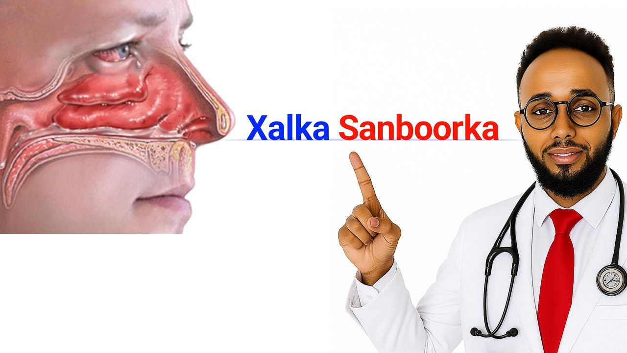 Cudurka sanboorka waxyabaha sababa  1080p