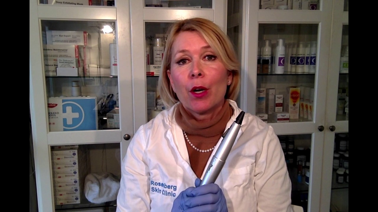 Cryopen, verwijderen van pigment, moedervlekken, fibromen, angiomen