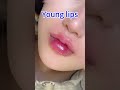 Charming and sexy lips#整形#变美#嘟嘟唇