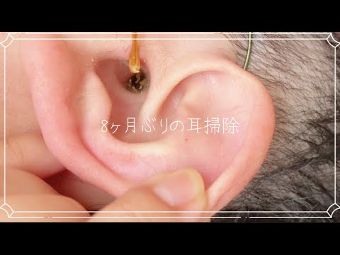 Видео: [耳掃除]8ヶ月ぶりのお掃除