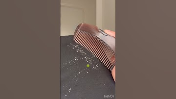 All This is coming out from My “CLEAN” scalp!!🤢😭(dandruff comb) #haircare #dandruff #hair #shorts