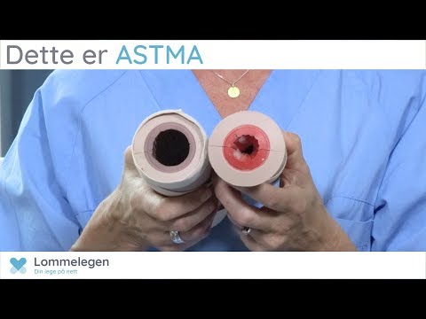 Dette er ASTMA - Lungesykdommer - Lommelegen