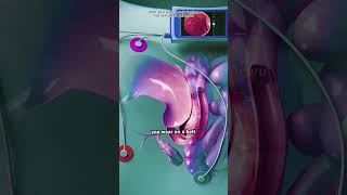 Capsule Endoscopy(3D Animation)