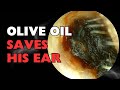 Olive Oil Saves His Ear