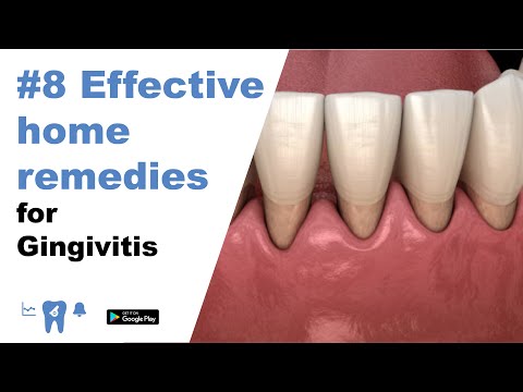 8 Effective home remedies for gingivitis.