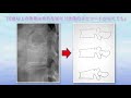 【ダイジェスト版】研修医のための診察手順　第10巻「腰痛の診かた」