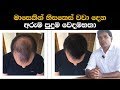 මාසෙකින් හිසකෙස් වවා දෙන අරුම පුදුම වෙදමහතා | Hair growth ayurvedic treatment By Doctor Dayashantha
