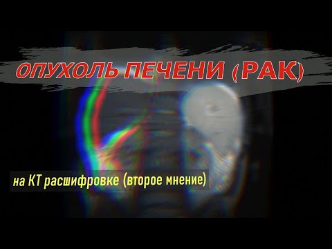 Бейне: Карциноматозды қалай анықтауға болады?