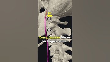 The Vagus Nerve Reset in Pain.