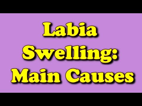 Video: Swollen Labia: Příčiny, Léčba A Další
