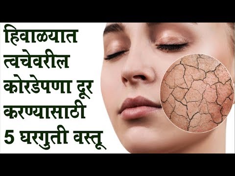 आता हिवाळ्यात कोरडी होणार नाही त्वचा  get rid of dry skin in the winter