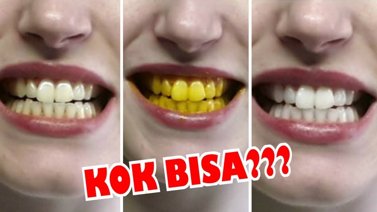 KUNYIT Bisa PUTIHKAN GIGI Yang Kuning KOK BISA YouTube