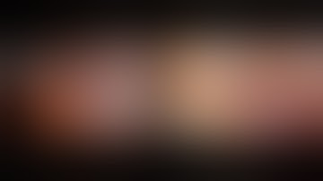 Robot vs FlexDex Side-by-Side