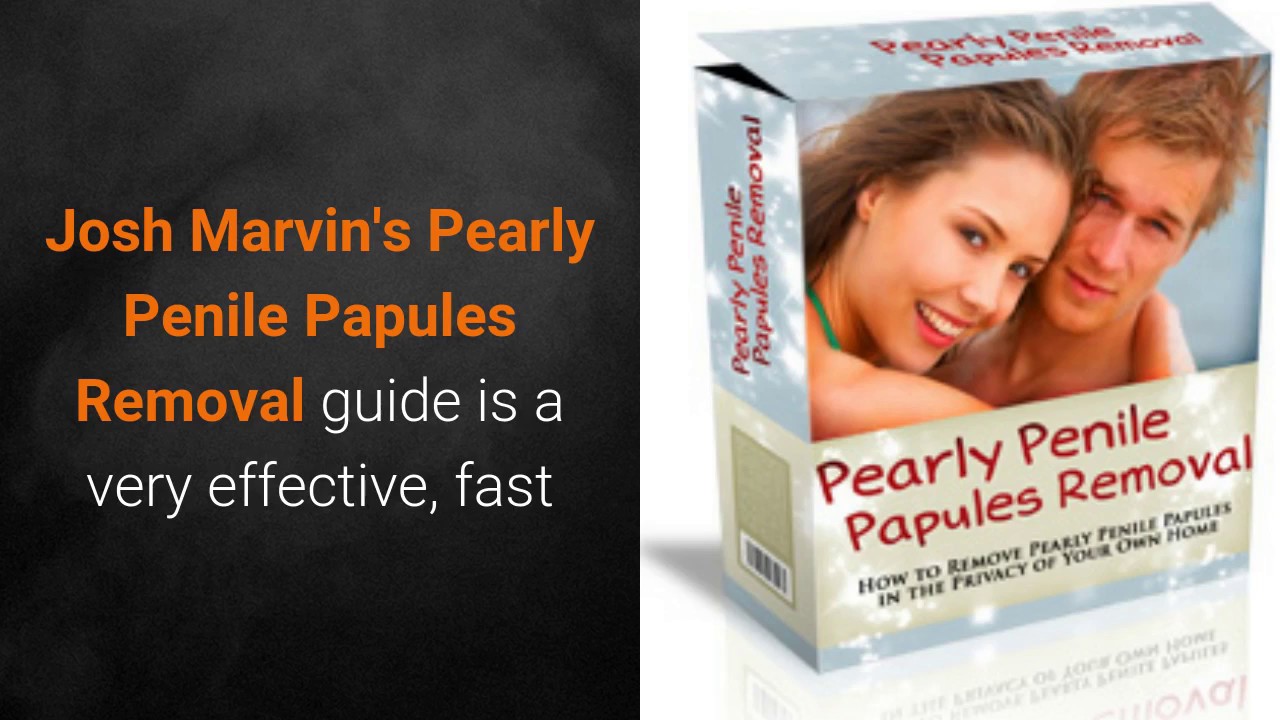 Papules pearly wiki penile Pearly Penile