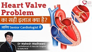 Heart Valve Problems का सही इलाज क्या है l Leaky Heart Valve l Mechanical & Tissue Heart Valves