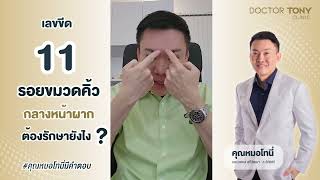 ขีด 11 รอยขมวดคิ้วกลางหน้าผาก ต้องรักษายังไง? #คุณหมอโทนี่มีคำตอบ
