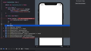 SwiftUI Alert
