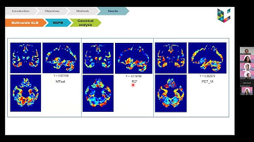 Soodeh Moallemian - Demyelination, iron, and synaptic loss in AD using multimodal imaging techniques