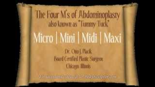 The Four M's of Abdominoplasty "Tummy Tuck":Chicago