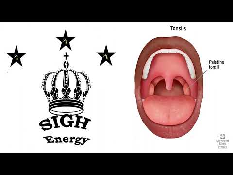 Tonsils Healing and Regeneration Plus EXTREMELY POWERFUL!!! (Energetically Programmed)