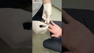 Kan Şekeri Ölçümü