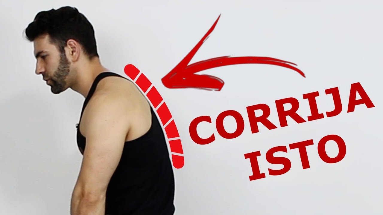 COMO CORRIGIR HIPERCIFOSE (EXERCÍCIOS FÁCEIS)